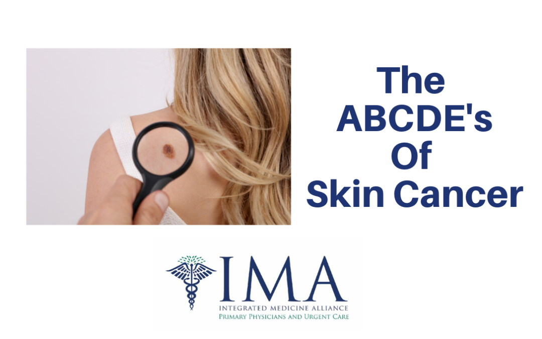 Abcde S Of Skin Cancer Integrated Medicine Alliance